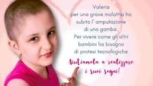 valeria, la raccolta fondi del papà per acquistare protesi